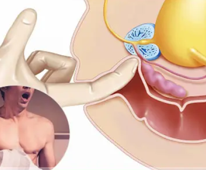 Hành vi tình dục và mối liên hệ với ung thư ống hậu môn